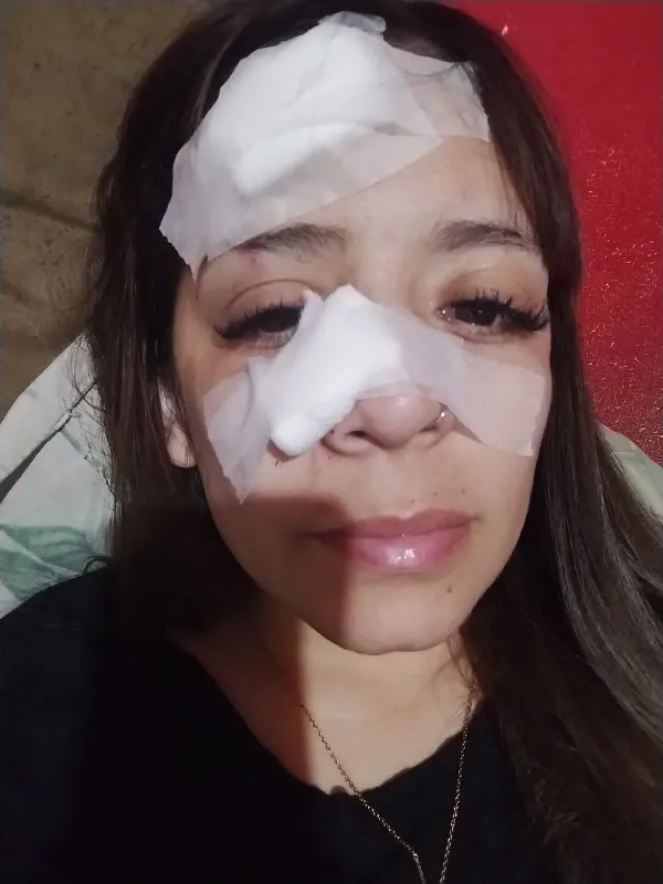 Una mujer terminó con fractura nasal tras ser atacada a piedrazos