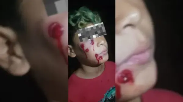 Grave denuncia contra la Policía Bonaerense: Niño recibió balazos de goma durante un operativo