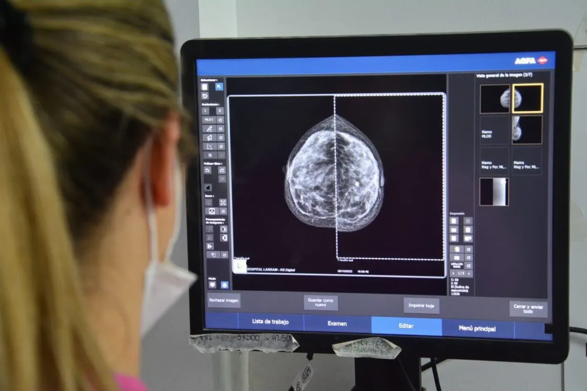 QAC y el Hospital Iriarte facilitan el acceso a mamografías