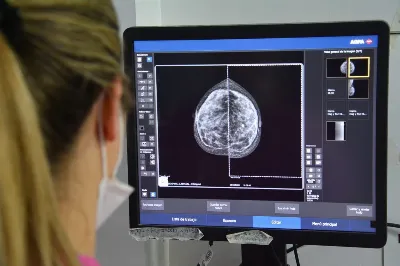 QAC y el Hospital Iriarte facilitan el acceso a mamografías